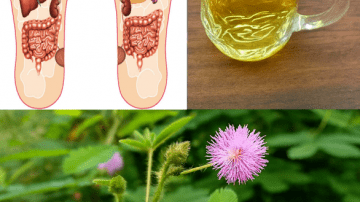 12 Kidney-Damaging Foods You Might Be Eating Daily