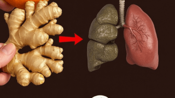 Boost Vein Health Naturally with Garlic and Onion