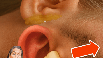 Boost Vein Health Naturally with Garlic and Onion