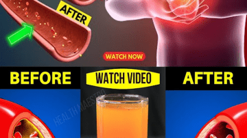 Boost Vein Health Naturally with Garlic and Onion