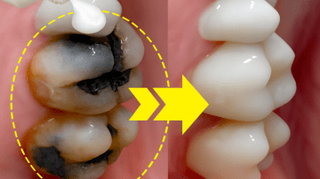 Aloe, Cloves, and Garlic for Gut Health