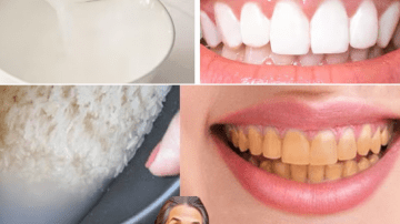 Aloe, Cloves, and Garlic for Gut Health