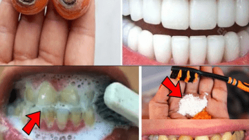 Aloe, Cloves, and Garlic for Gut Health