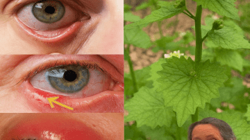 Discover Garden Gold: Dandelion’s Hidden Power