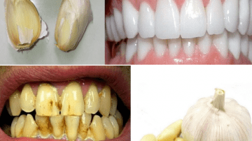 Transform Your Smile with Garlic’s Hidden Power