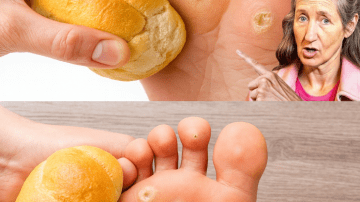Spot These Signs: Save Your Kidneys Now