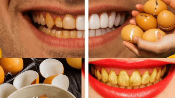 Unlock a Radiant Smile: Nature’s Secrets for Oral Health