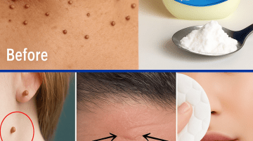 Guard Your Smile: Natural Ways to Prevent Cavities