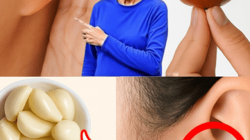 Grow Hair Fast in 4 Weeks with Homemade Onion Oil