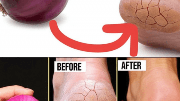 Repel Mosquitoes Naturally with Fragrant Remedies