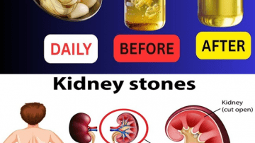 Seniors, Drink Bone Broth for Knee Pain Relief