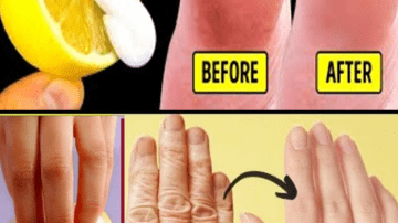 Unlock Beetroot’s Hidden Power for Fibroids and Cysts