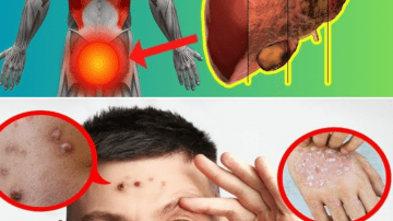 Top Vitamin to Ease Proteinuria and Support Kidneys