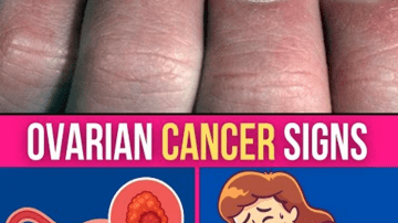 Sip This to Boost Knee Cartilage Health