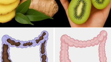 Lower Creatinine Naturally: 5 Fruits for Kidney Health