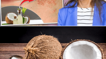 Lower Creatinine Naturally: 5 Fruits for Kidney Health