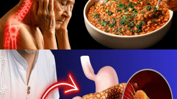 5 Foods to Stop Kidney Stones in Their Tracks