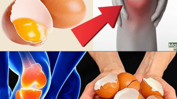 Grow Hair Fast in 4 Weeks with Homemade Onion Oil