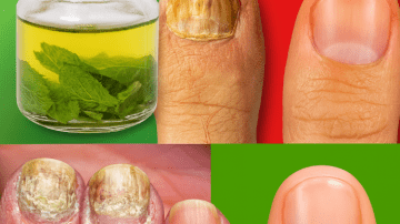 Fade Dark Spots with Baking Soda Mask