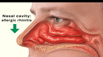 Fast Relief: Sip Away Joint Pain Naturally and Reclaim Your Freedom