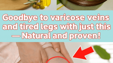 Do These 10 Things to Protect Your Kidneys for Life