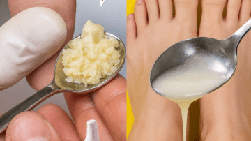Rub This to Destroy Wrinkles & Boost Collagen in 7 Days!