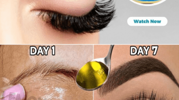 How To Get Rid of Nail Fungus Using Garlic: A Natural Remedy With Hidden Potential