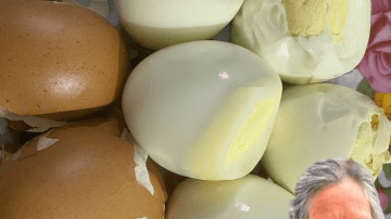 How To Get Rid of Nail Fungus Using Garlic: A Natural Remedy With Hidden Potential