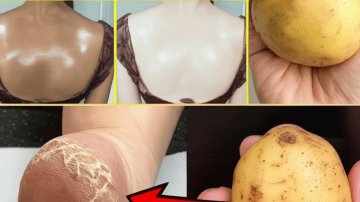 Onion in Sock: A Natural Health Boost