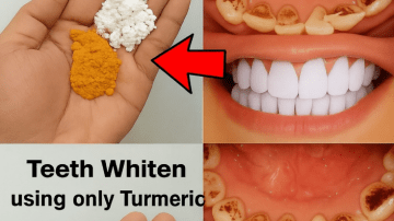 DENTISTS HATE THIS: The 7-Day Natural Routine That Could Help Stop Tooth Decay — Inspired by Barbara O’Neill