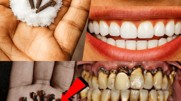 Discover Ginger’s Hidden Power to Rejuvenate Your Skin Naturally