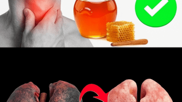 10 Dangerous Foods Harming Your Pancreas Health