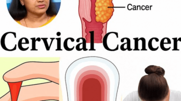 Unlock Cloves’ Hidden Magic: Your Daily Ritual for Radiant Teeth and Breath That Turns Heads